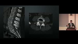 Case Presentation: Navigation/AR/VR/Robotics/Endoscopy