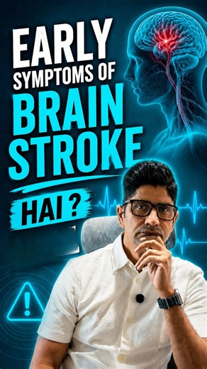 How to Recognize a Stroke FAST? Know These Warning Signs #shortvideo