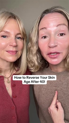 We wanted to talk a little bit about aftercare for advanced skin treatments like microneedling and lasers. We recommend use a repair cream like the Anua PDRN Hyaluronic Acid 100 Moisturizing Cream. We also recommend that you avoid direct sun exposure and use a good sunscreen when you might be exposed to the sun. This Anua cream will help to repair and rejuvenate the skin cells after the treatment that creates micro-injuries. It will work in synergy with your cell’s repair systems to create the g