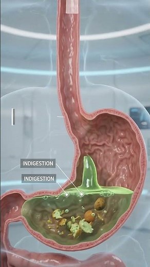 Stomach Acid & Indigestion: What Happens Inside Your Stomach? #HumanAnatomy #usashorts #usa