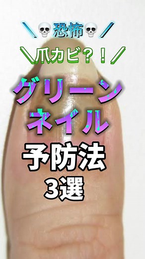 グリーンネイルの症状と対処法ガイド