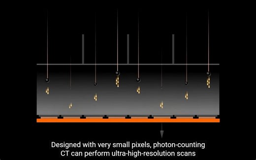 Siemens西门子光子计数CT介绍