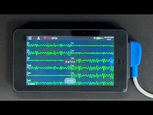 Configuration Pocket ECG - Connexion WiFi et envoi par mail