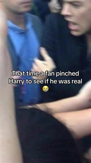 When a Fan Pinched Harry Styles: A Memorable Moment