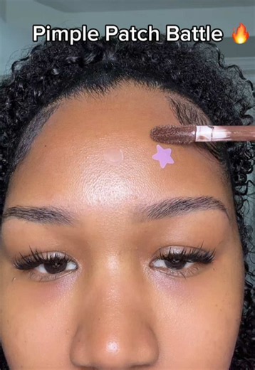 I am obsessed with these pimple patches 😊🥰 @Dr.Melaxin #koreanskincare #pimplepatch #melaxinpartner