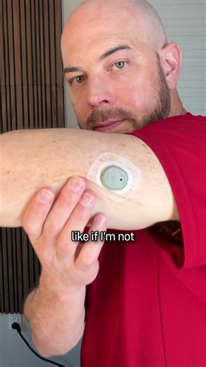 This small monitor has changed the way I see my health #cosmeticdermatology #skincare #health