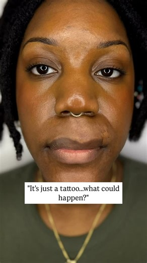 ANNA BOKHAN on Instagram: "Tattoo no one now’s she has done, but it literally..changed her smile forever 🥹 cleft lip - dog bite - burn survivor - tattoo - cosmetic tattoo - Mara studio - Mara colors"