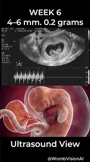 WEEK 6 — Now 4–6 mm and about 0.2 grams #pregnancyjourney #pregnancy #ultrasound