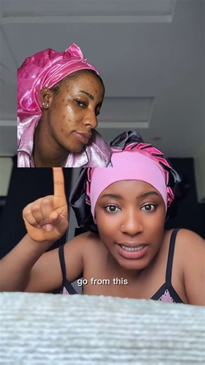 Best African Black Soap for Dark Spots: Honest Review & Price (250g)