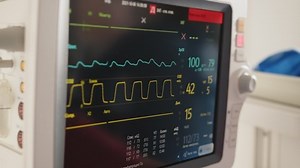 clip-1088843881-monitor-vital-signs-patient-hospital-heart-rate