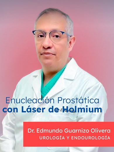 ¿Conocías la cirugía HOLEP? La enucleación prostática con láser de Holmium, conocida como HOLEP, es una técnica avanzada y mínimamente invasiva para tratar la hiperplasia prostática benigna (HPB). Este procedimiento utiliza un láser de alta precisión para eliminar el tejido prostático obstruido, ofreciendo una recuperación más rápida y menos complicaciones que las cirugías tradicionales. Si buscas una solución efectiva y moderna para problemas prostáticos, HOLEP podría ser la respuesta que neces
