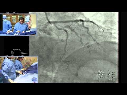 Complex PCI Case Study: Part 1 - Introduction and Patient Access