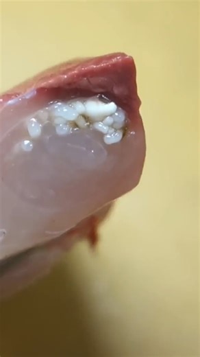 Tapeworm Found!😱 | Hiroyuki Terada - Sushi Master