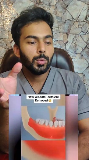 Wisdom Tooth Surgical Extraction! . . #wisdomtoothextraction