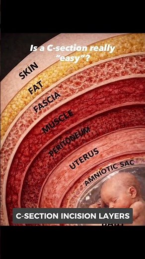C Section Delivery Explained | 7 Layers Doctors Go Through During Cesarean Surgery