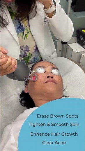 Reveal smoother, brighter skin with Nouvaderm laser ✨