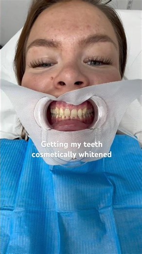 Getting my teeth cosmetically whitened!