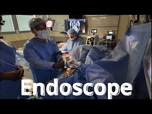 2024 - Fully Endoscopic Microvascular Decompression