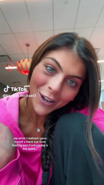 Dealing with a Black Eye After Hunting