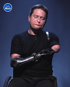 80K views · 50 reactions | I lost all four of my limbs to a flesh-eating bug - and I'm loving life! | Daily Mail Did That Just Happen? | Facebook