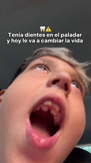 Transformación dental: de dientes torcidos a sonrisa perfecta