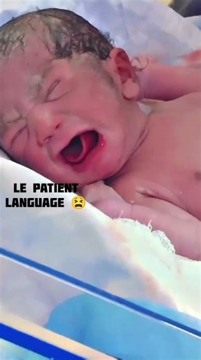 Comment down the clinical features in patients language🥺🥲#baby#shorts#viralshorts#trending#cutebaby