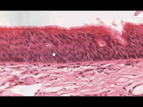 Histologia - Epiglotis