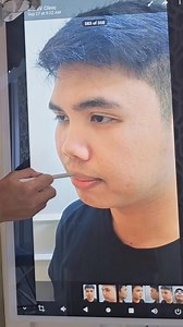465K views · 5.3K reactions | 1. Macho gwapo nose 2. Pogi chin 3. Wafu lips | Clara V Clinic | Facebook