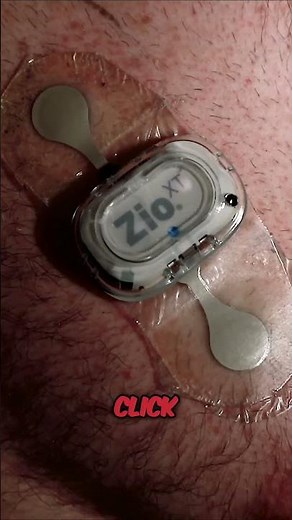 The Ultimate Sticker for Tracking Symptoms Does It Really Work