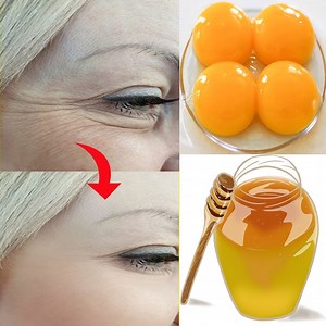 Honey is one of nature's most revered skin remedies. Thanks to its antibacterial and antiseptic abilities, it may benefit oily and acne-prone skin. Honey is also a natural humectant, so it helps keep the skin moist but not oily. This is because humectants draw moisture from the skin without replacing it. | ELEGANT BEAUTY