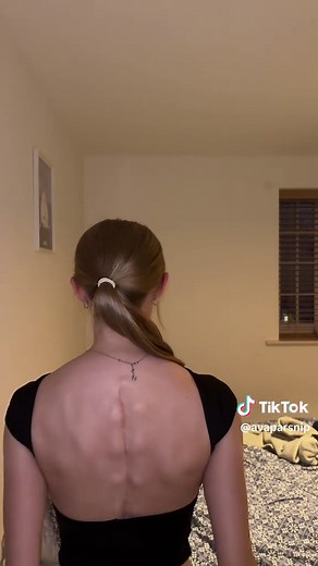 Understanding Scoliosis Surgery and Spinal Fusion