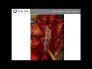 Urethral Strictures • Video • MEDtube.net