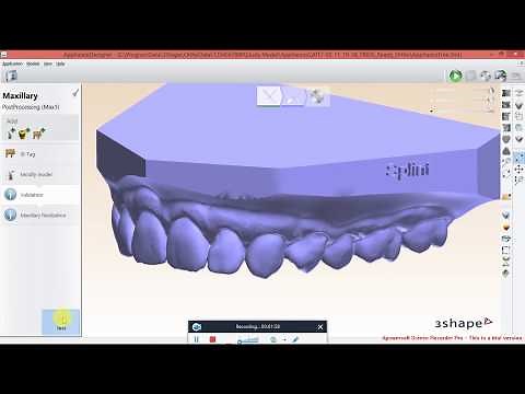 How to Export Ortho Study Models with ID Tags in 3Shape