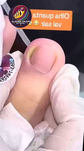 14K views · 124 reactions | Simple tips help runners enjoy long-term foot health #trustedcare #gentlehealth #dailywellness | Alishba Anjum vlog | Facebook