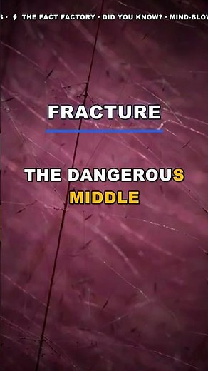 Your Bones Are Leaking: The Osteopenia Shock