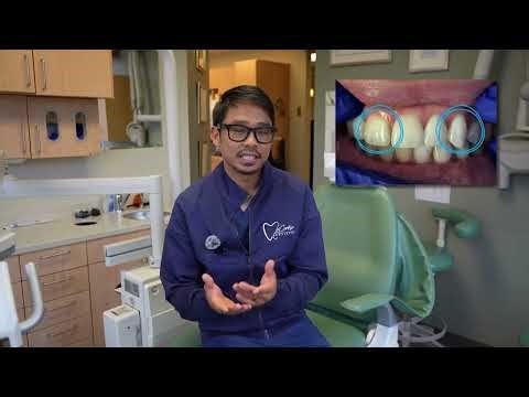 Resin Infiltration at Le Centre Dentistry of Minneapolis