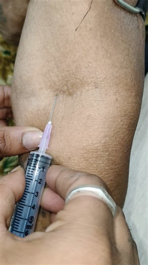 #blood #lab #bloodtest #laboratory