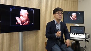 2.3K views · 35 reactions | Samsung Medison accelerates image processing in ultrasound systems, resulting in more efficient and accurate diagnosis, using Intel architecture and #oneAPI software. Learn more about the Intel oneAPI Base Toolkit: https://intel.ly/36IQ8UK | Intel Dev Tools | Facebook