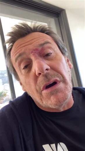 Jean-Luc Reichmann dans le coma‼️… 😂😂😂 #pourtoi 👍 #coma