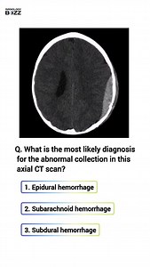 632 reactions · 151 shares | 易 Radiology Quiz: Can You Identify the...