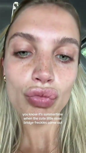 Never gotta use that freckle pen #fyp #freckles #summertime