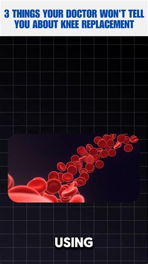 If your doctor told you to get Knee Surgery, you need to see this...👀 | Kennedy Health Center