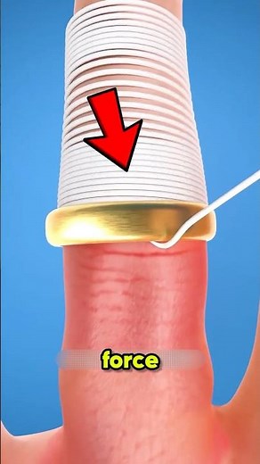 Never Pull a Stuck Ring Off Like This! 💍😱 #LifeHacks #HealthTips #DidYouKnow