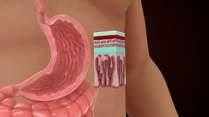 Parietal Cells Oxyntic Cells Stomach 3d Stock Footage Video (100% Royalty-free) 3459730131 | Shutterstock