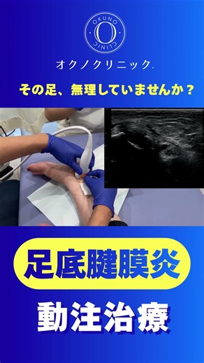 For those with heel pain on the first step of the morning