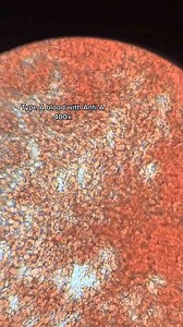 What’s Your Blood Type?