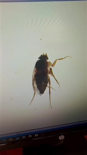 “Zooming into genetics: Male Drosophila melanogaster under the microscope, the tiny powerhouse of biological research.” The male fruit fly is distinguished by features such as darker and rounded… | Qurat ul Haq