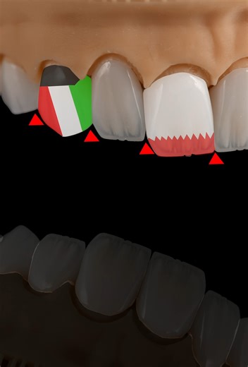 MICRO DENTAL LAB on Instagram: "Where Technology Shapes the Perfect Smile” At Micro Lab, every restoration begins with cutting-edge digital systems. From 3D scanning to high-precision milling, our technology ensures accuracy, durability, and unmatched beauty. 🦷 Advanced tech. Advanced smiles. #MicroLab #DigitalDentistry #CADCAM #Zirconia #Emax #DentalTechnology #SmileInnovation"
