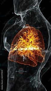 3D Human Lungs On X-Ray Screen With Alpha Channel