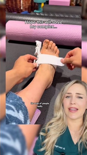 Doctor reacts: bunion treatment